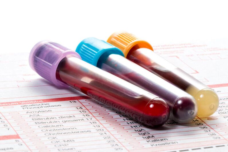 Blood test